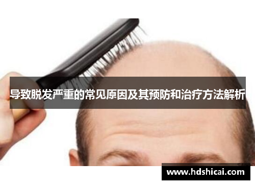 导致脱发严重的常见原因及其预防和治疗方法解析